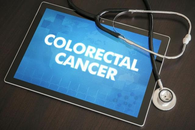 A Kaiser Permanente systematic outreach program doubled colon cancer screening rates, researchers are scheduled to report at the upcoming Digestive Disease Week meeting in San Diego. Adobe stock/HealthDay