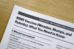 Three more states confirm measles cases